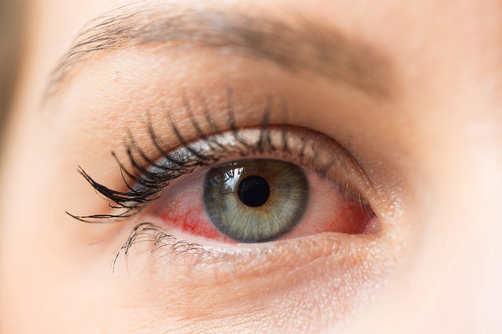 Do Eye Vitamins Help Age-related Eye Disease?